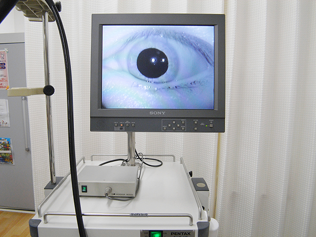 赤外線CCD眼振検査装置